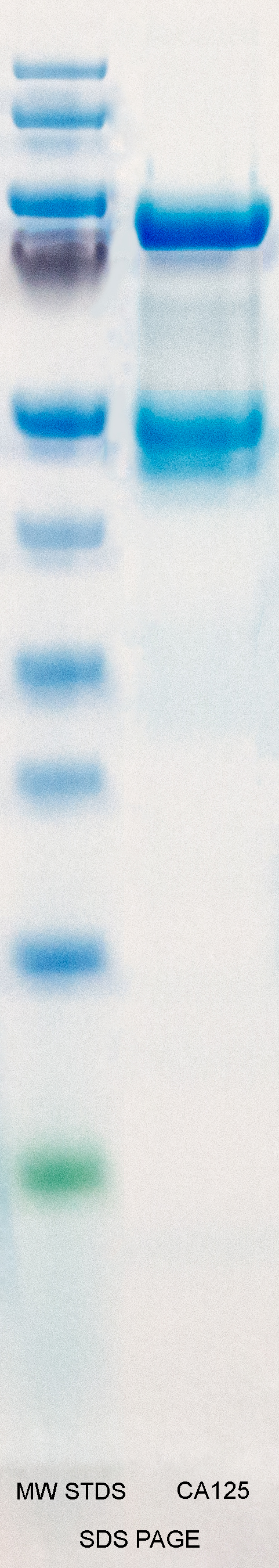 Cancer Antigen 125 (CA125)