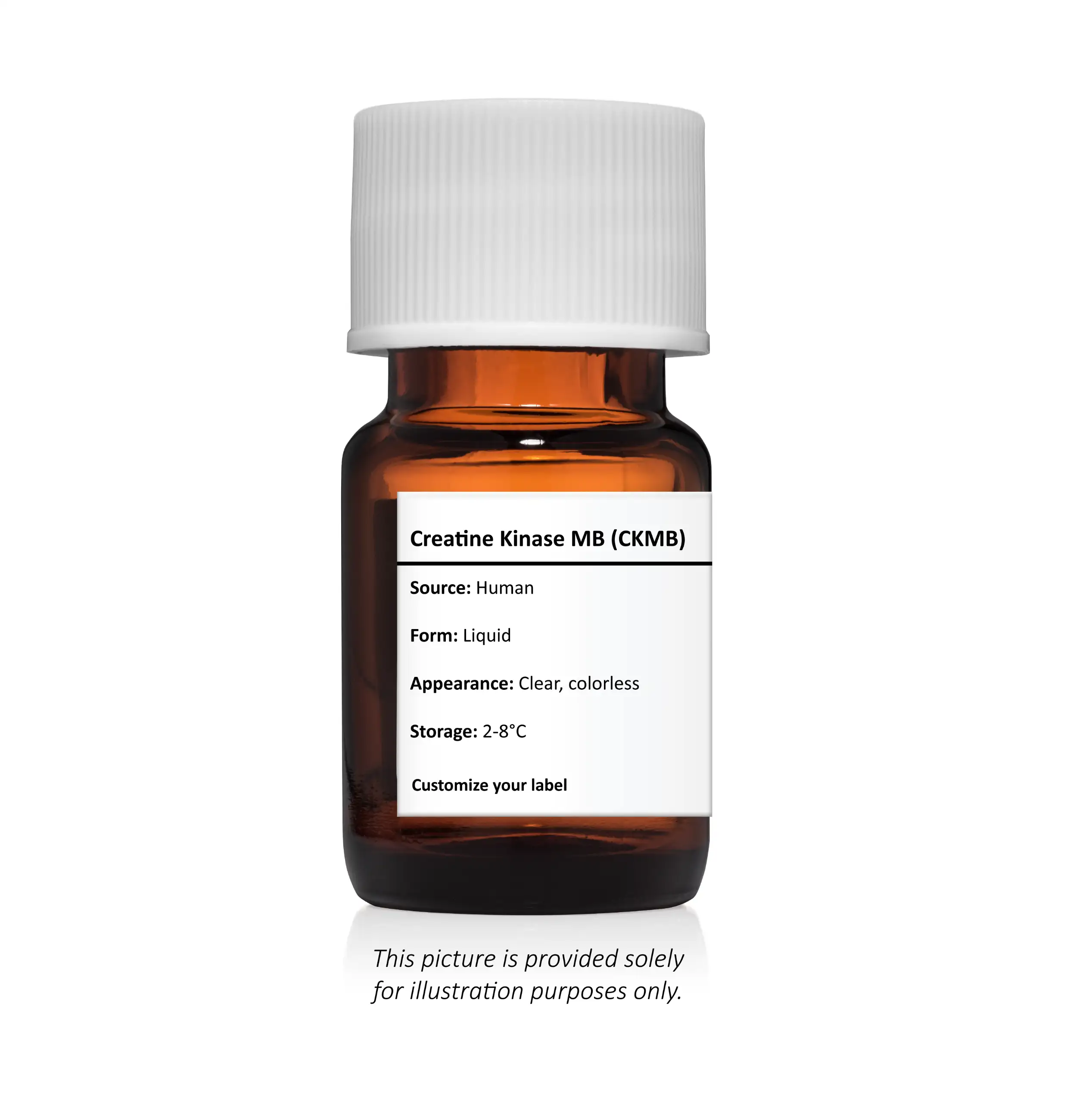 Creatine Kinase MB (CKMB)